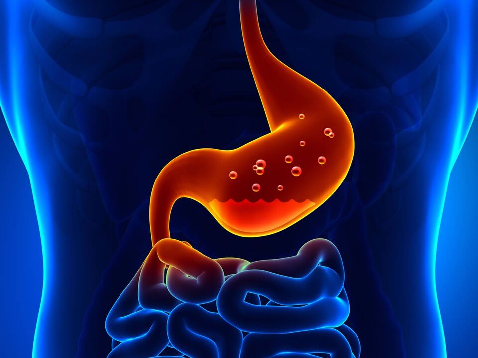 gastritis en el estómago